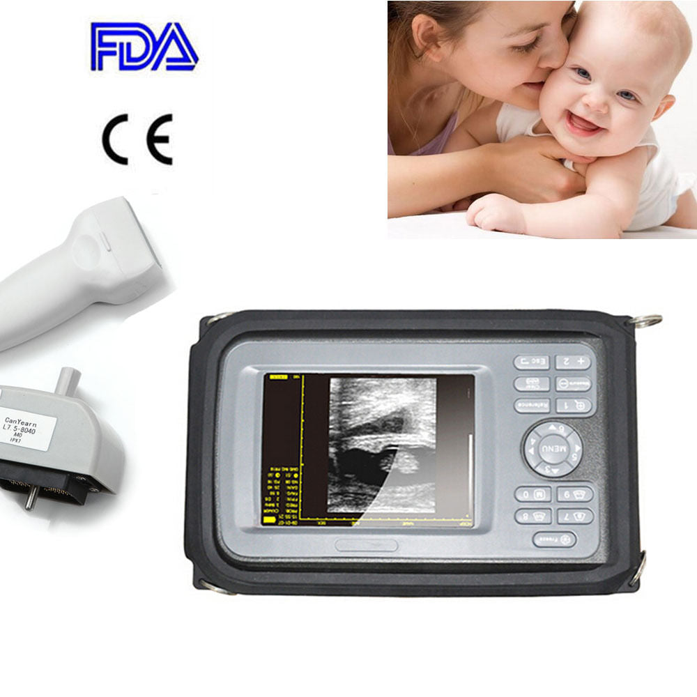 5.5 " Handheld Ultrasound Scanner/Machine Digital +Linear Probe For Human CE DIAGNOSTIC ULTRASOUND MACHINES FOR SALE