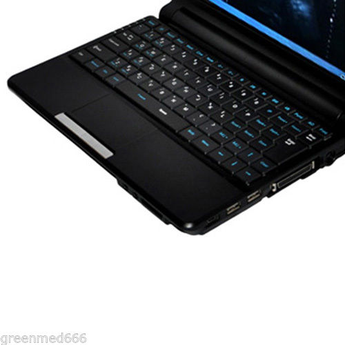 7.5M Linear Probe Full Digital Diagnostic System Ultrasound Scanner Machine New 190891735249 DIAGNOSTIC ULTRASOUND MACHINES FOR SALE