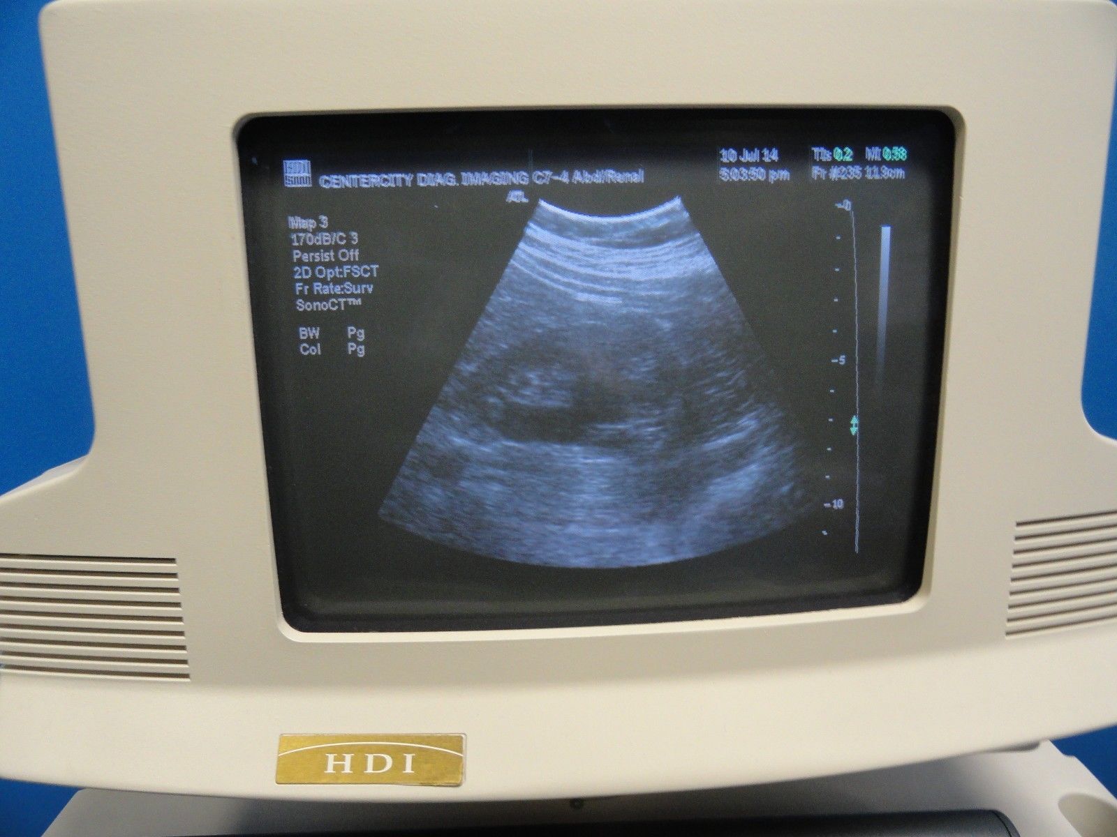 ATL C7-4 40R Curved Array Convex Ultrasound Probe for ATL HDI Series (6867) DIAGNOSTIC ULTRASOUND MACHINES FOR SALE