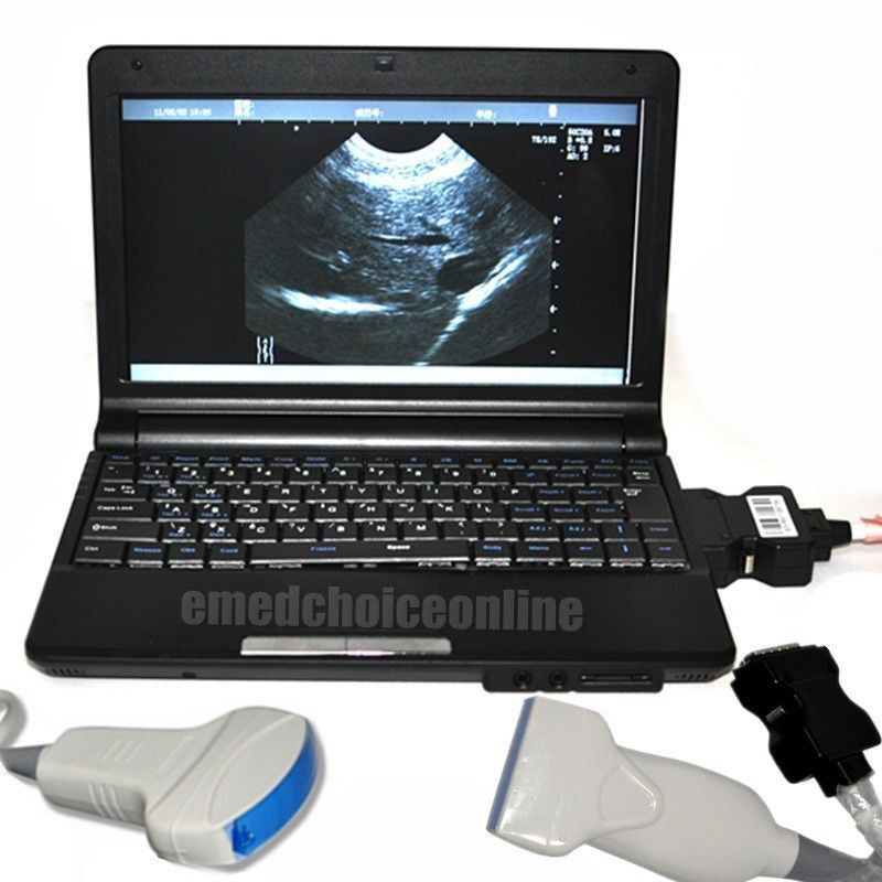 Full Digital Laptop Ultrasound Scanner 2 Probes Covex + Linear Probes 3D Precise 190891802569 DIAGNOSTIC ULTRASOUND MACHINES FOR SALE
