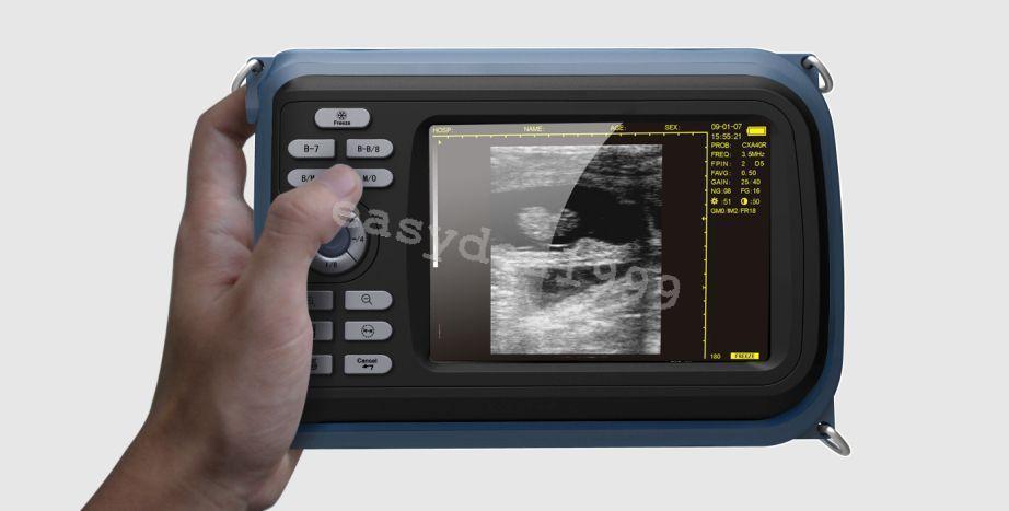H8 Portable Handheld Full Digital Ultrasound Scanner Machine Micro-Convex Probe DIAGNOSTIC ULTRASOUND MACHINES FOR SALE