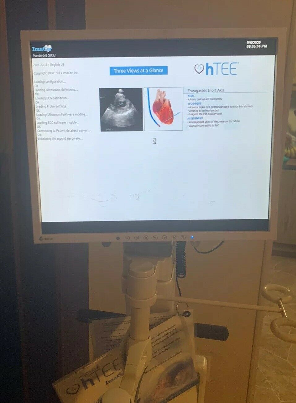 ImaCor Hemodynamic Ultrasound Machine Zura-1000 System DIAGNOSTIC ULTRASOUND MACHINES FOR SALE