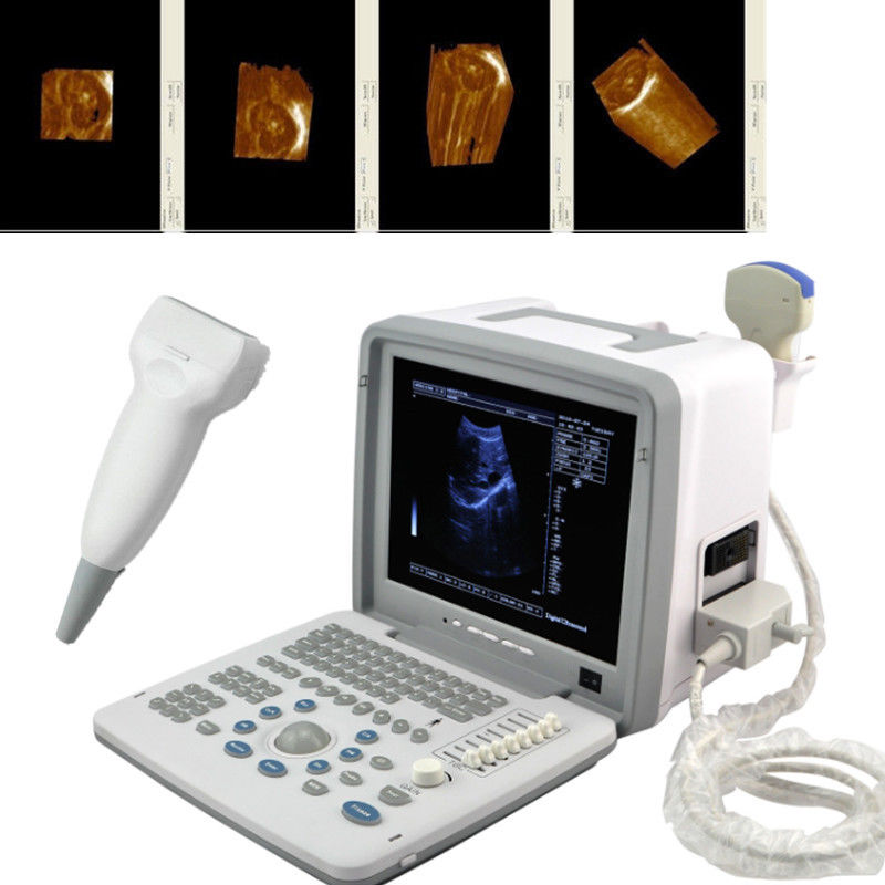 Portable 12'' SVGA LCD Digital Ultrasound Scanner System Convex Linear Probes 3D 190891802217 DIAGNOSTIC ULTRASOUND MACHINES FOR SALE