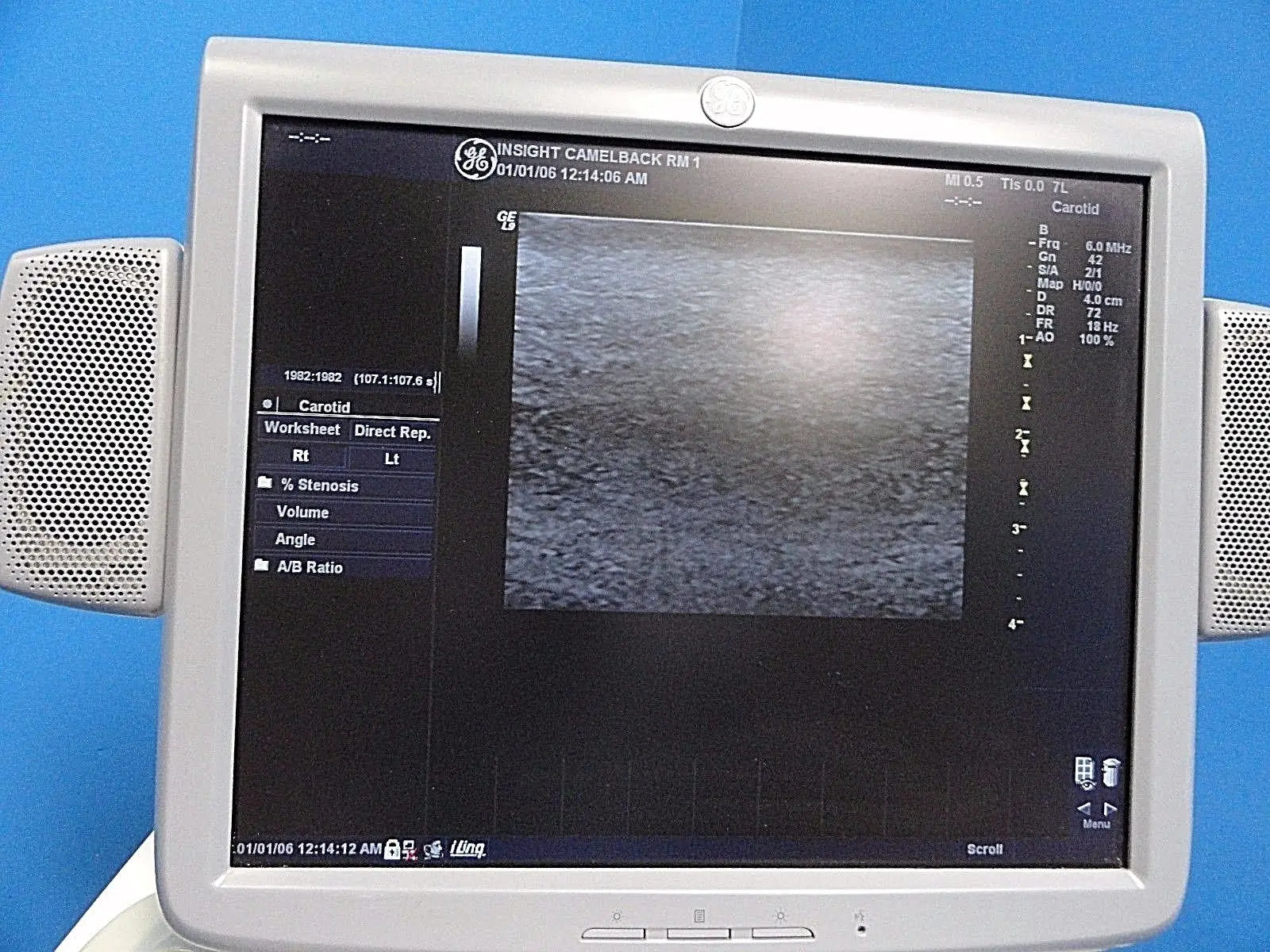 GE 7L Linear Array Ultrasound Probe P/N 2197482 for Logiq & Vivid Series~13729 DIAGNOSTIC ULTRASOUND MACHINES FOR SALE