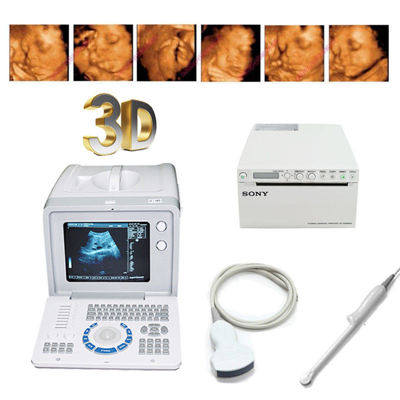 Medical Ultrasound Scanner +Transvaginal,Convex Probes+ UP-97MD Printer Machine 190891976185 DIAGNOSTIC ULTRASOUND MACHINES FOR SALE