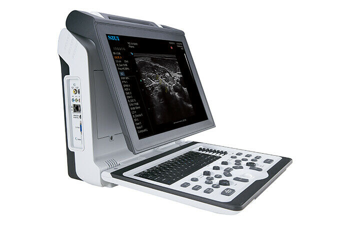 Portable OB/GYN Ultrasound Machine - SIUI Apogee 2300, 2 Probes