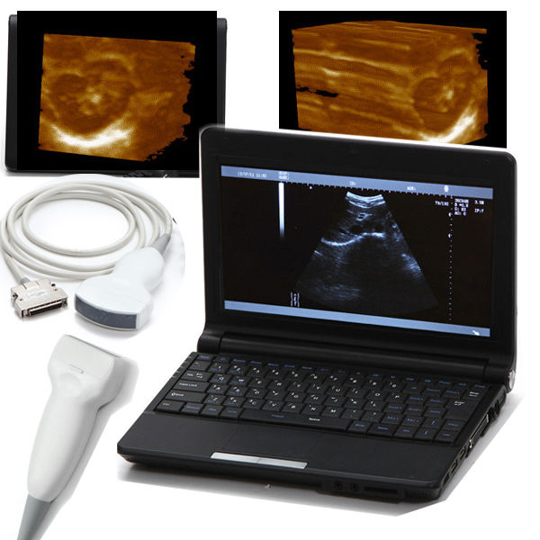 Hot CE Convex+Linear Probe,Digital Portable Laptop Ultrasound Scanner+Free 3D 190891829993 DIAGNOSTIC ULTRASOUND MACHINES FOR SALE