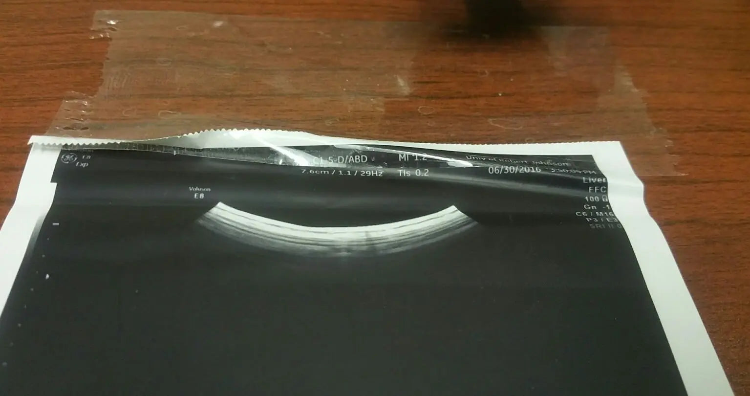 GE C1-5-D Ultrasound Transducer Probe DIAGNOSTIC ULTRASOUND MACHINES FOR SALE