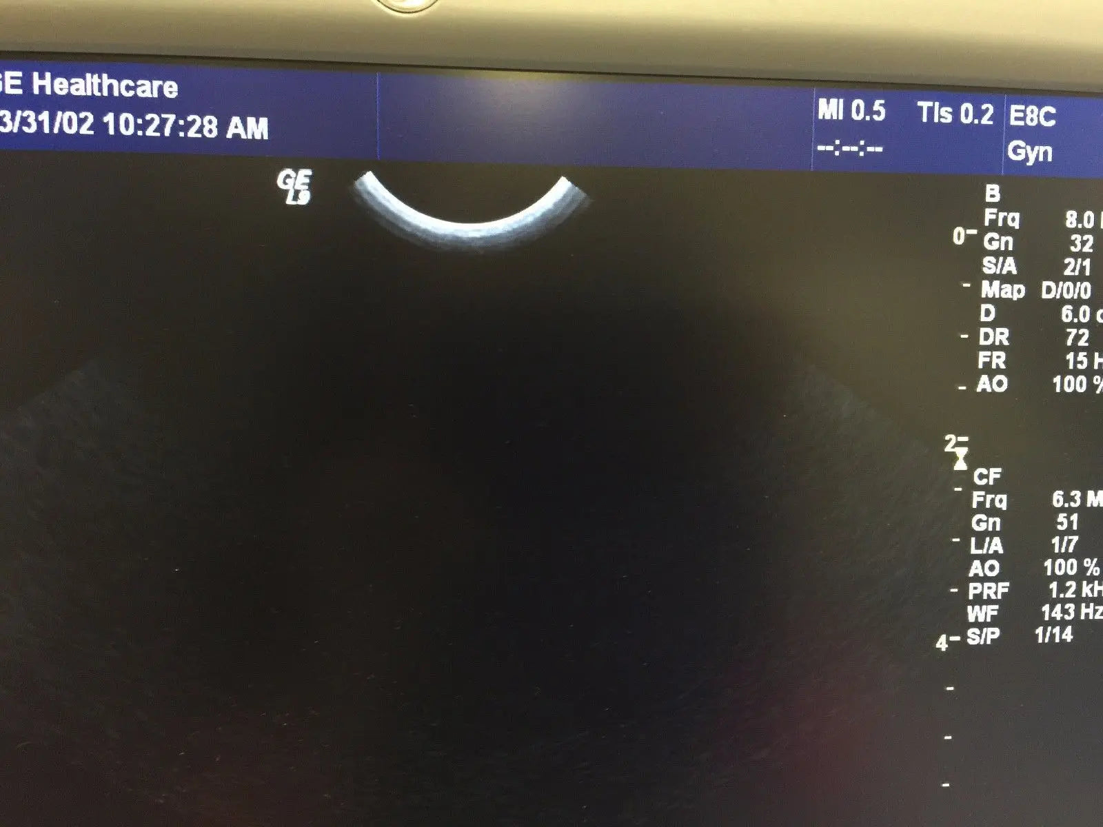 GE E8C Endocavity Ultrasound Transducer for GE Logiq Systems DIAGNOSTIC ULTRASOUND MACHINES FOR SALE