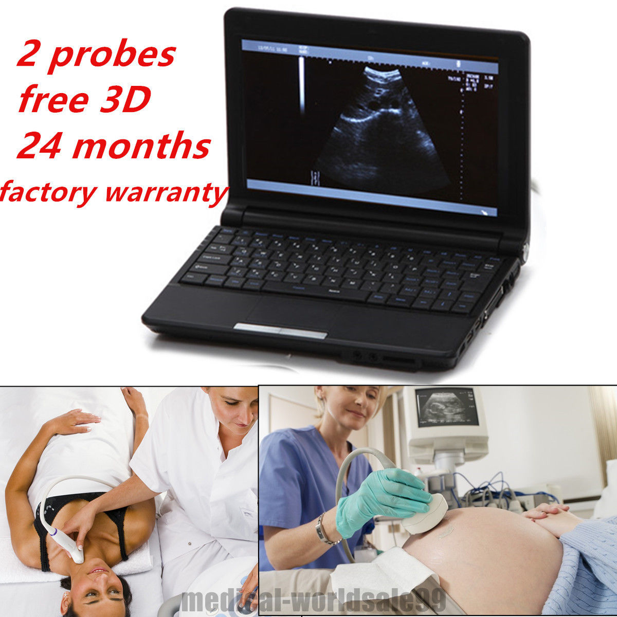 Notebook Digital Ultrasound Scanner/Exam Machine Convex + Linear 2 Probes 3D AA DIAGNOSTIC ULTRASOUND MACHINES FOR SALE