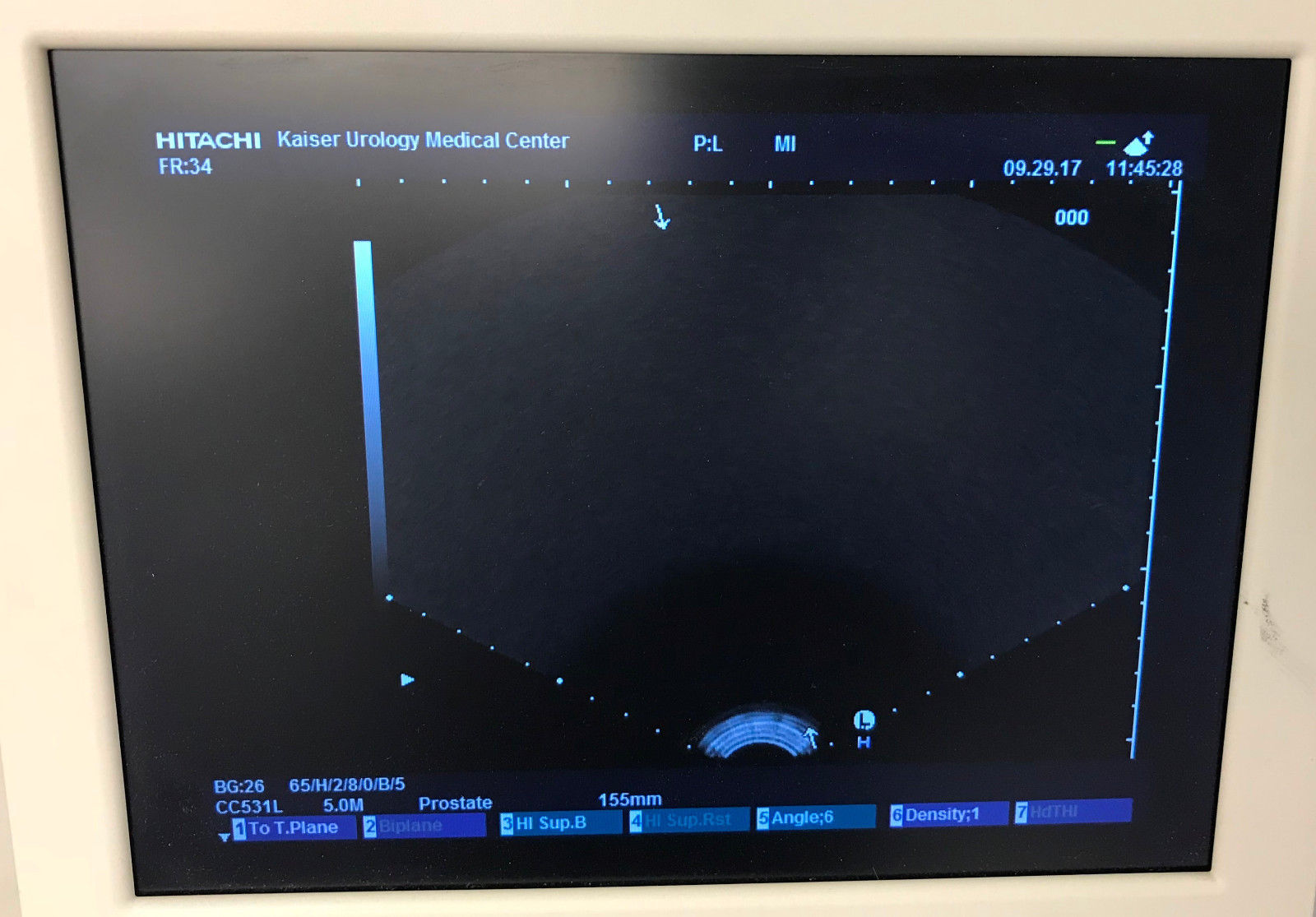 Hitachi HI Vision 5500 Ultrasound Diagnostic Scanner EUB-5500 w/ 3 Transducers DIAGNOSTIC ULTRASOUND MACHINES FOR SALE