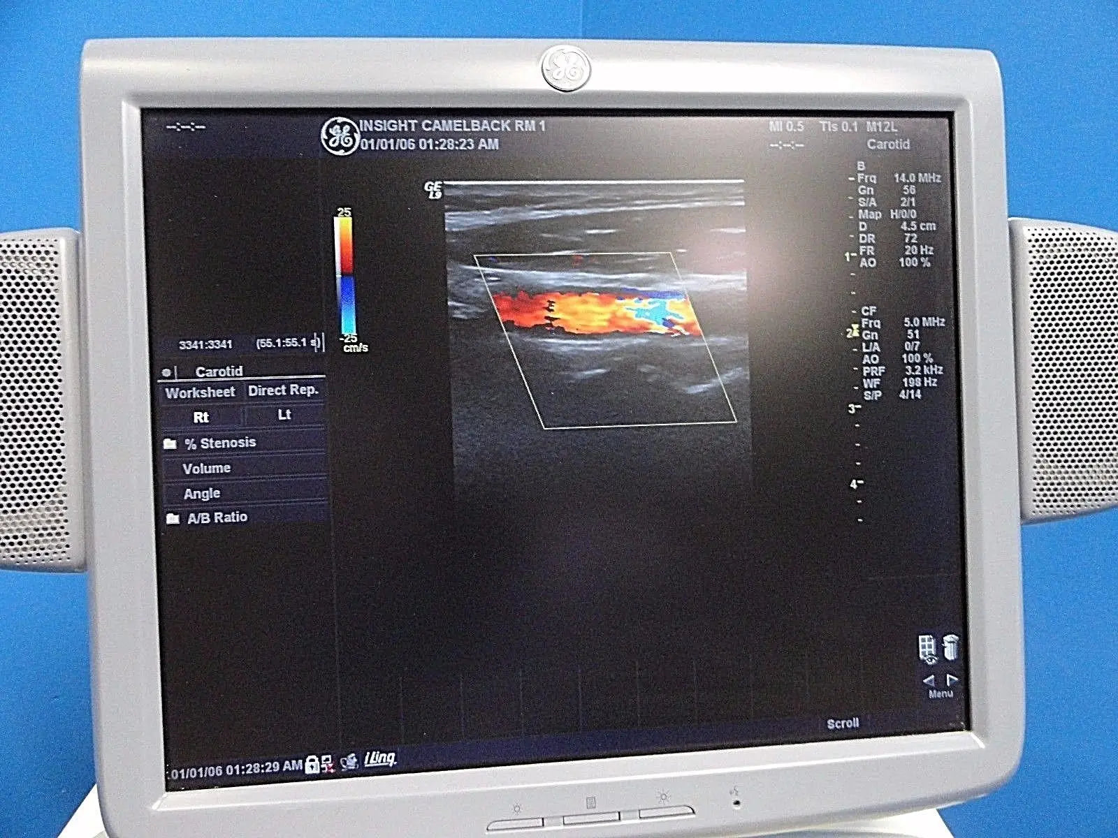 GE M12L P/N 2294512 Linear Array Ultrasound Probe for Logiq & Vivid Series~13722 DIAGNOSTIC ULTRASOUND MACHINES FOR SALE