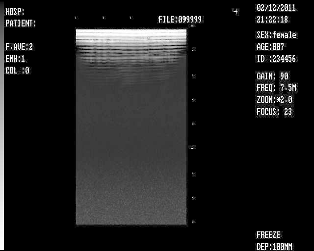 New +3D Digital Ultrasound Scanner +Convex Transvaginal probes 2 probes Set Sale 190891051066 DIAGNOSTIC ULTRASOUND MACHINES FOR SALE