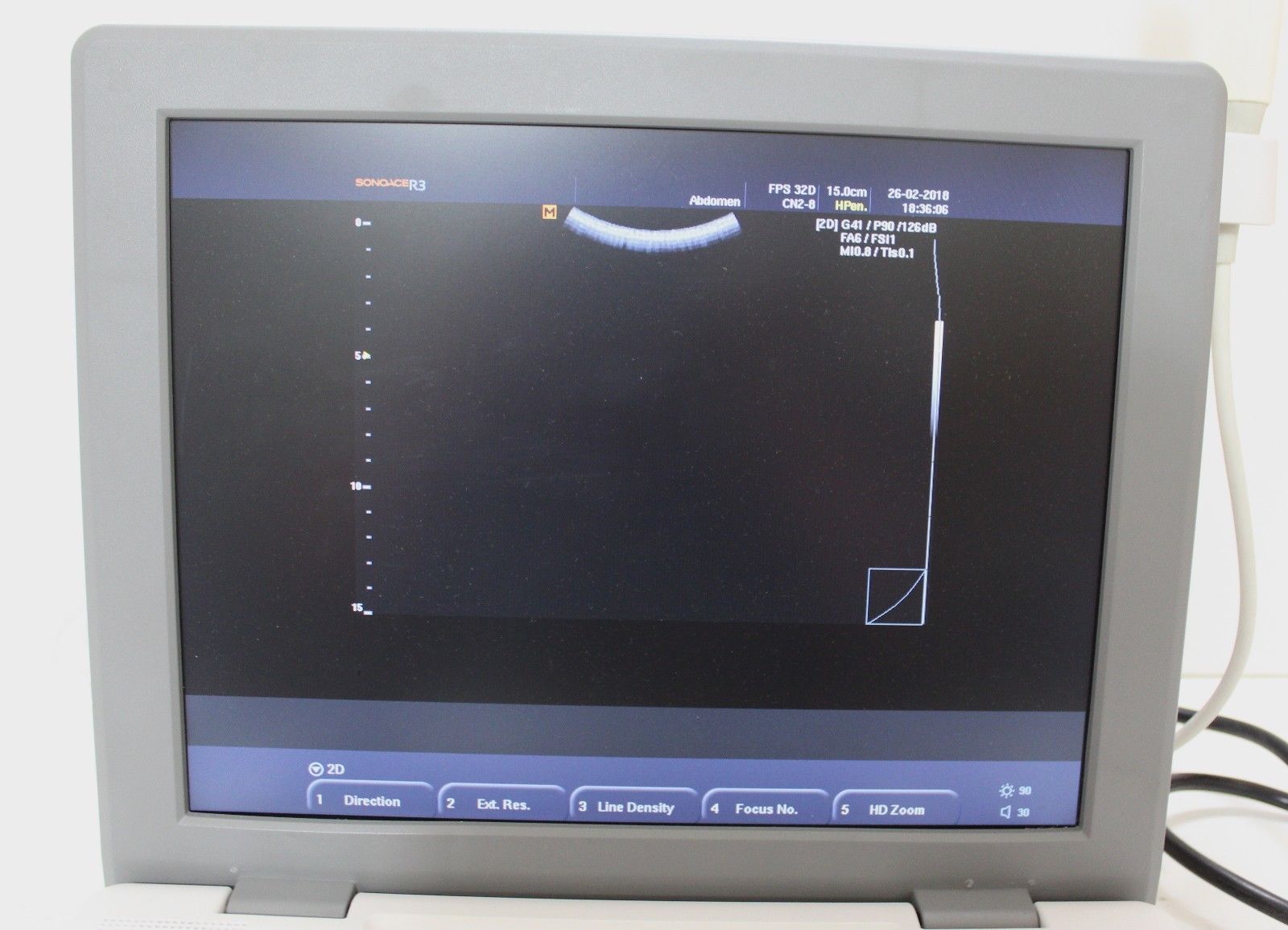 SonoAce R3 Samsung Medison portable ultrasound With one convex Probe CN2-8 DIAGNOSTIC ULTRASOUND MACHINES FOR SALE