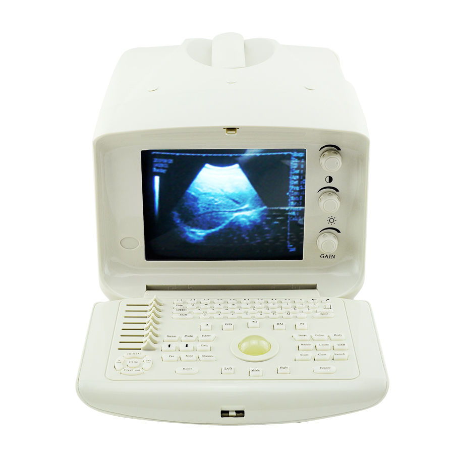 Portable Digital Ultrasound Scanner machine + Linear Probe Shallow Layer 3D Sale 190891928498 DIAGNOSTIC ULTRASOUND MACHINES FOR SALE