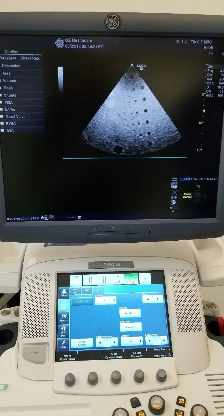 GE M5S-D Ultrasound Probe / Transducer Demo Condition DIAGNOSTIC ULTRASOUND MACHINES FOR SALE