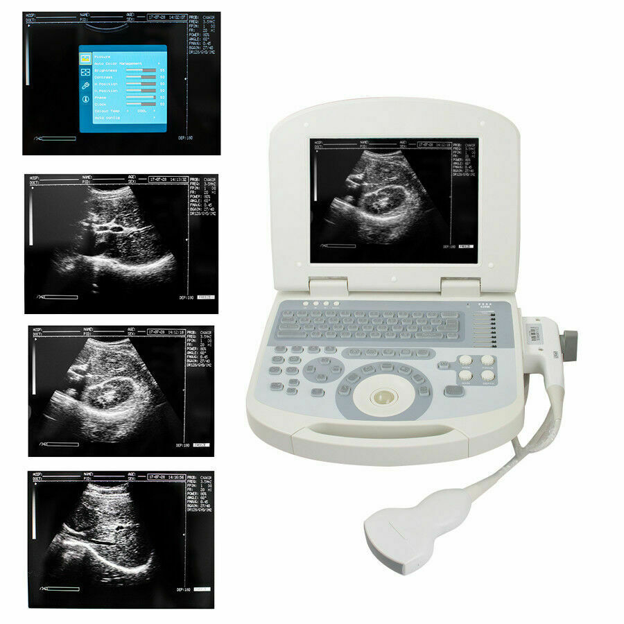 New Portable Notebook Digital Laptop Machine Ultrasound Scanner Convex Probe+3D DIAGNOSTIC ULTRASOUND MACHINES FOR SALE