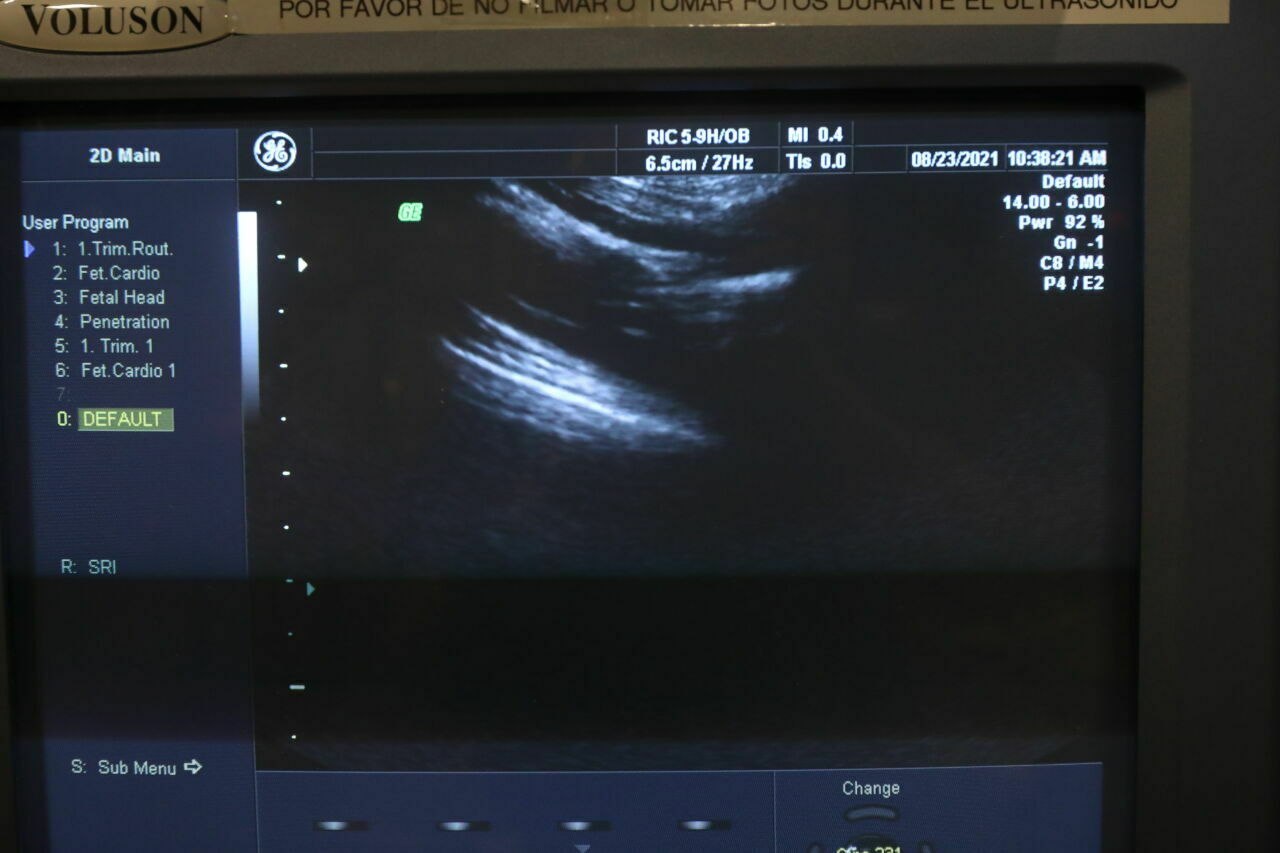 GE RIC5-9H Ultrasound Transducer DIAGNOSTIC ULTRASOUND MACHINES FOR SALE