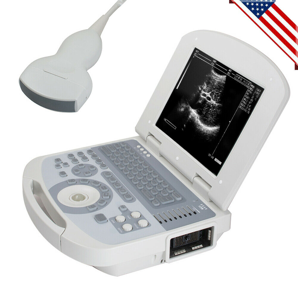 Digital Medical Ultrasound Scanner +3.5MHZ Convex Probe with 3D Software DIAGNOSTIC ULTRASOUND MACHINES FOR SALE