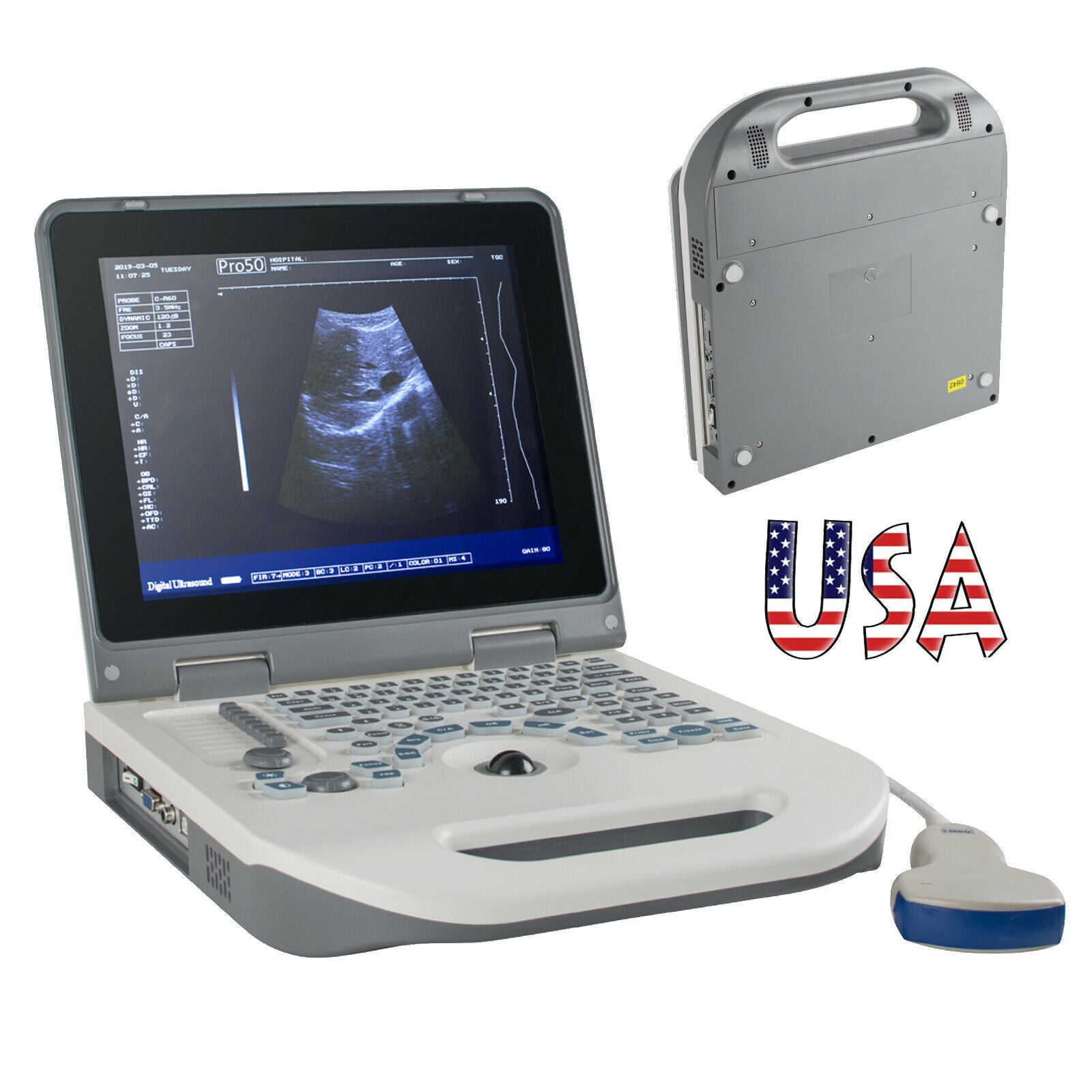 New Full Digital Ultrasound Scanner Ultrasonic MachineDisgnos Convex Probe 3D CE DIAGNOSTIC ULTRASOUND MACHINES FOR SALE