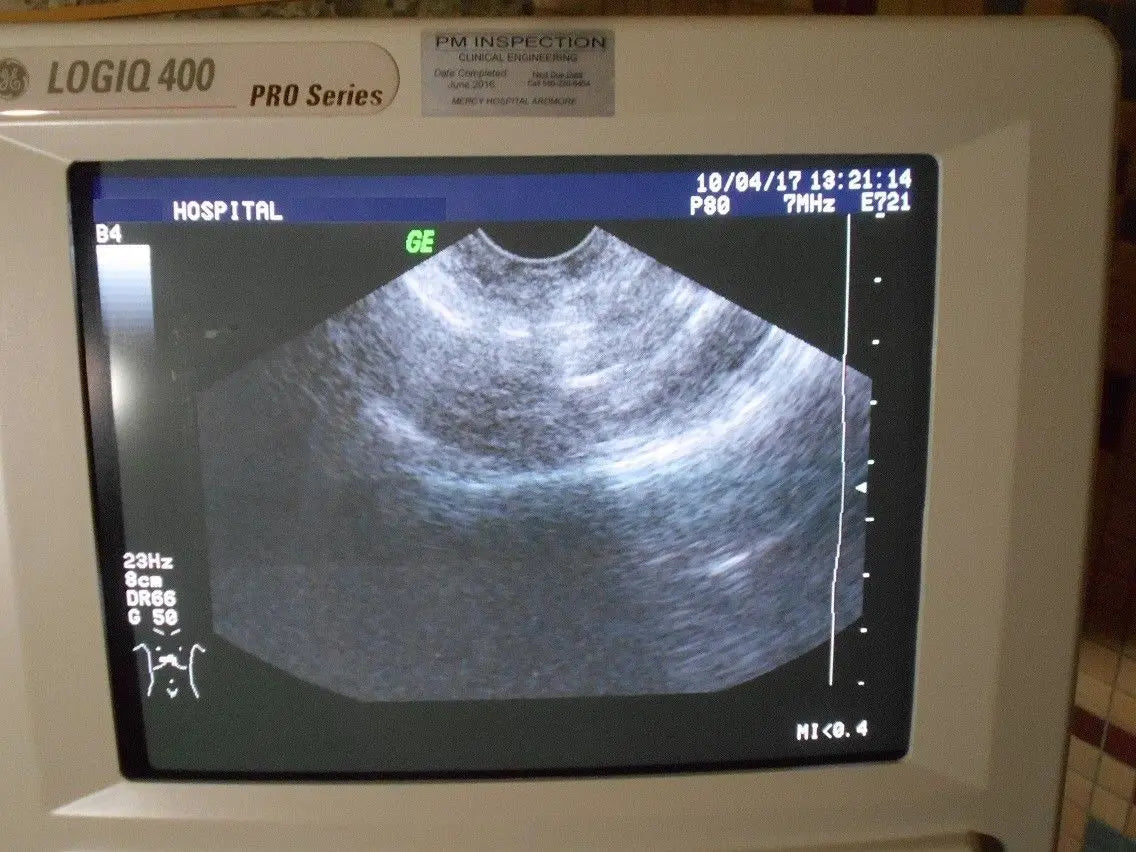 General Electric Logiq 400 2264468 Pro Series Ultrasound w/ Probes E721-C358-LA3 DIAGNOSTIC ULTRASOUND MACHINES FOR SALE