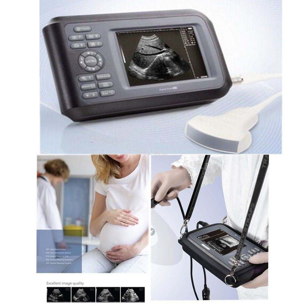 HandScan Full Digital Ultrasound scanner Machine Convex+ Transvaginal probe Case DIAGNOSTIC ULTRASOUND MACHINES FOR SALE