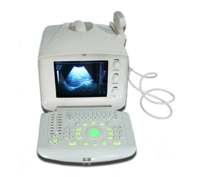 Portable Digital Ultrasound Machine/Scanner Micro Convex Probe 3D Workstation 01 190891781666 DIAGNOSTIC ULTRASOUND MACHINES FOR SALE