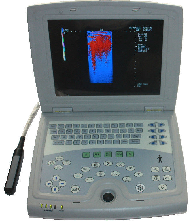 KX5000V Quality Veterinary Laptop Ultrasound Scanner LED & Rectal Probe-KeeboMed DIAGNOSTIC ULTRASOUND MACHINES FOR SALE