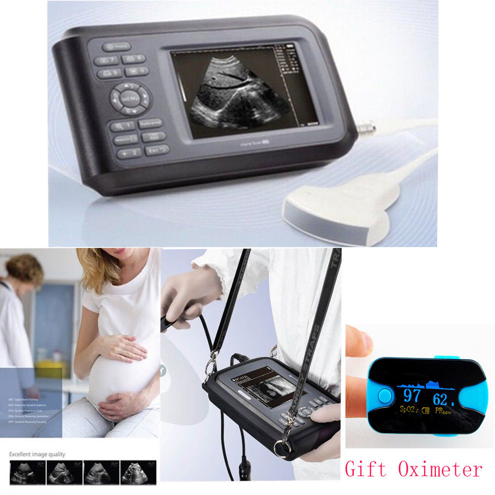 Portable Medical Ultrasound Scanner System Convex Probe Abdominal Free Oximeter DIAGNOSTIC ULTRASOUND MACHINES FOR SALE