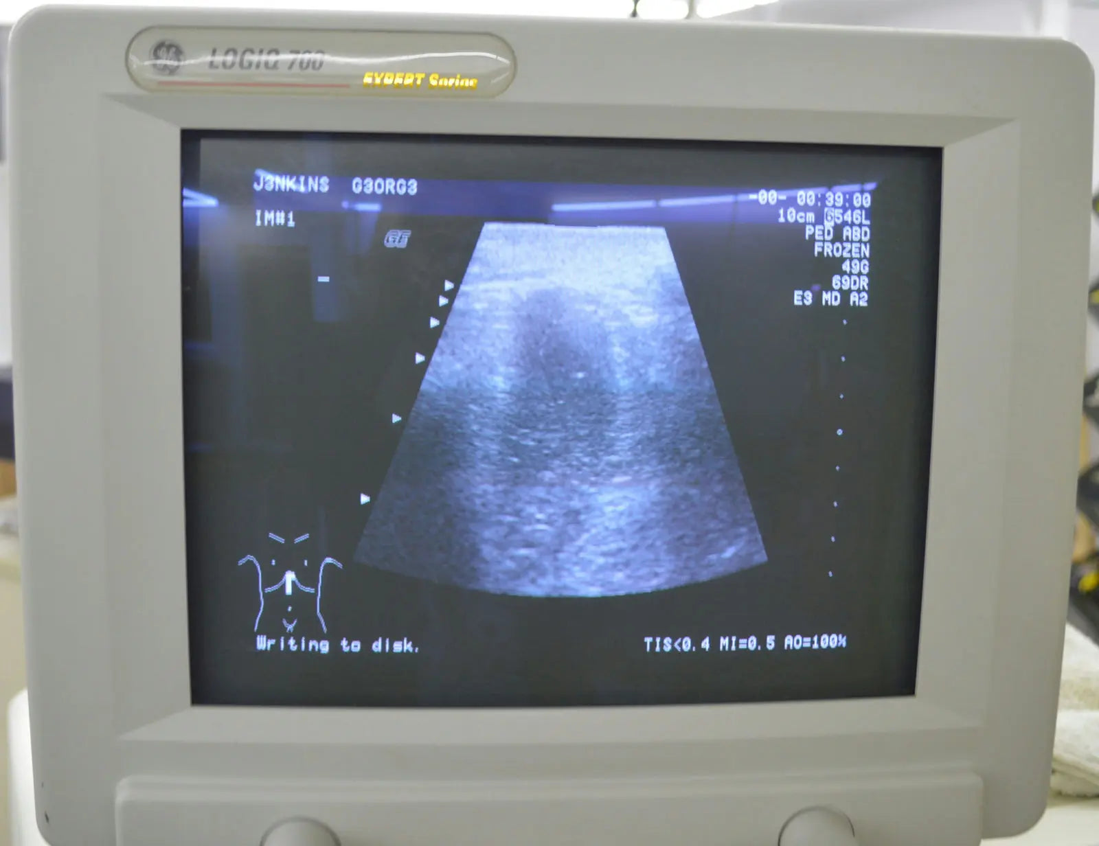 GE Logiq 700 Expert Series Ultrasound System w/ Two Transducers Probes 546L LA39 DIAGNOSTIC ULTRASOUND MACHINES FOR SALE