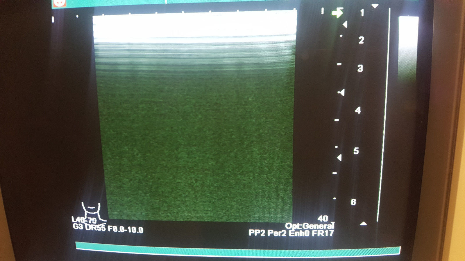 Shimadzu SDU-1200Pro Diagnostic Ultrasound unit 541-50049-03 OB, GYN, DIAGNOSTIC ULTRASOUND MACHINES FOR SALE