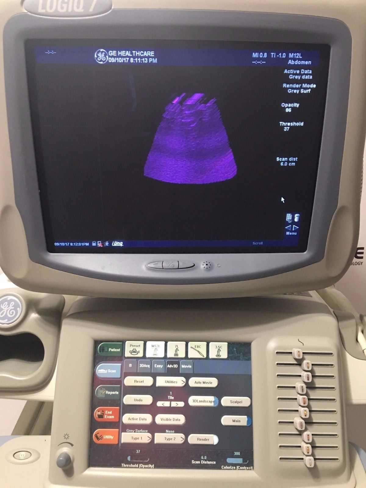 GE Logiq 9 Ultrasound System with 3.5C, E8C, 7L, 10L, and M12L Transducers DIAGNOSTIC ULTRASOUND MACHINES FOR SALE