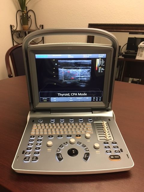 NEW Chison ECO 6 Portable Ultrasound System DIAGNOSTIC ULTRASOUND MACHINES FOR SALE