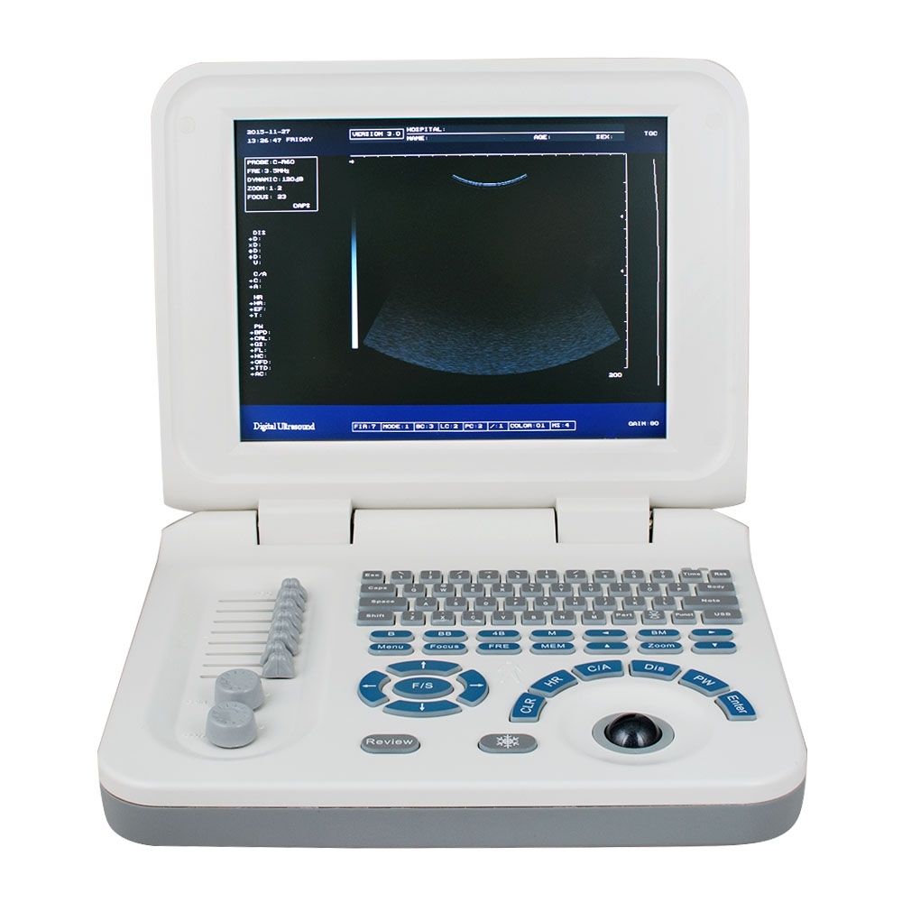 10" Portable Ultrasound Scanner Machine Micro-Convex Probe With Bag and Battery DIAGNOSTIC ULTRASOUND MACHINES FOR SALE