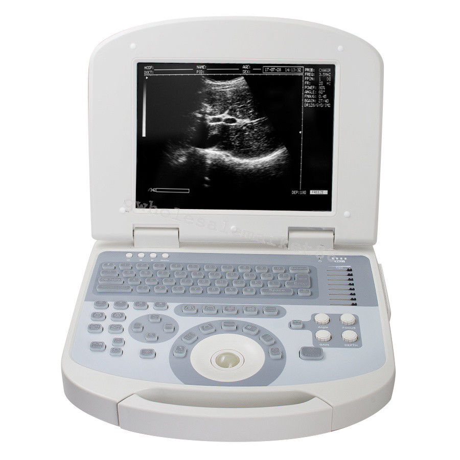 Laptop Ultrasound Machine Scanner Convex Probe 3D Software Clear Medical Clinic 190891045898 DIAGNOSTIC ULTRASOUND MACHINES FOR SALE