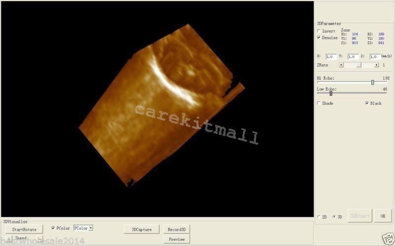 10.1'' Ultrasound Scanner+Convex,Linear,Transvaginal,Probe with thermal recorder DIAGNOSTIC ULTRASOUND MACHINES FOR SALE