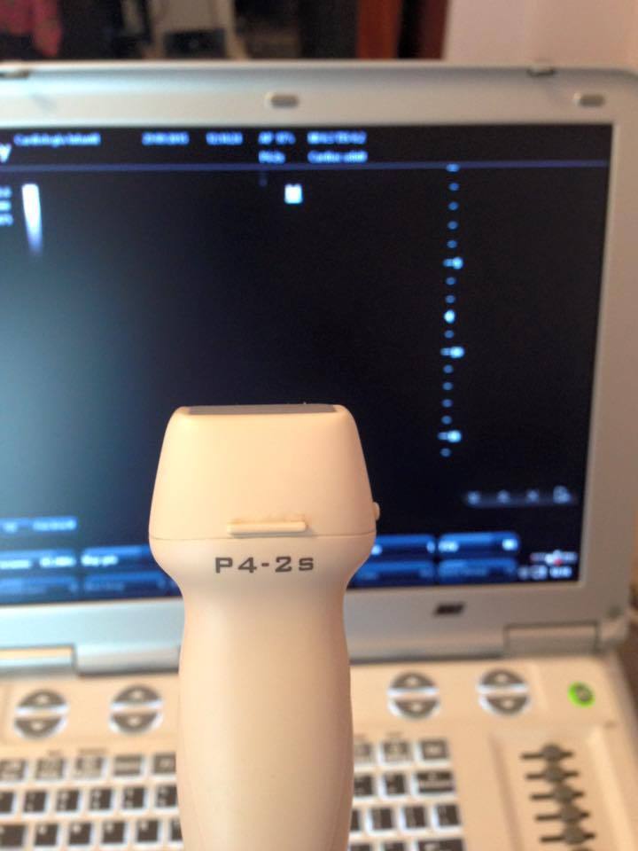 ;Mindray M7 Portable Ultrasound System w/ Probe 4P-2s DIAGNOSTIC ULTRASOUND MACHINES FOR SALE