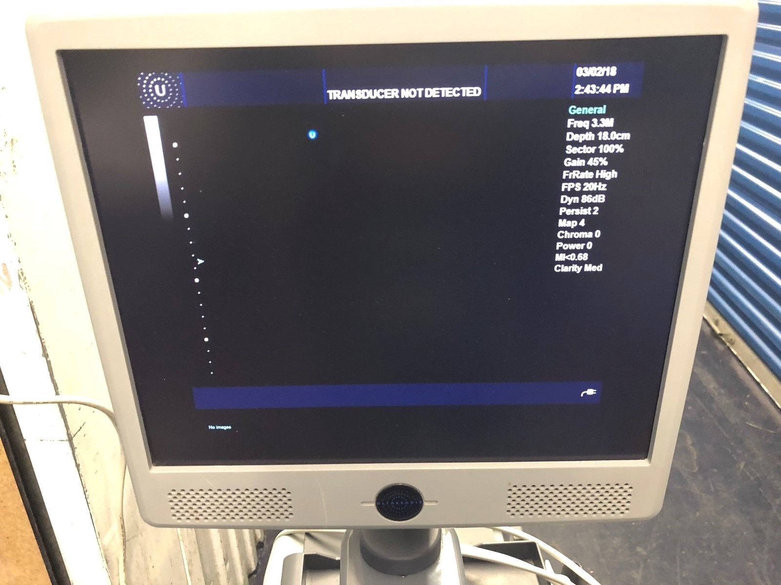 ULTRASONIX SONIXTOUCH OB / GYN - VASCULAR ULTRASOUND SYSTEM DIAGNOSTIC ULTRASOUND MACHINES FOR SALE