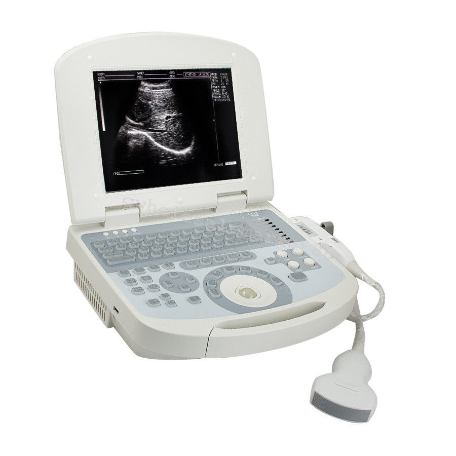 Laptop Ultrasound Machine Scanner System Convex probe+ 3D Workstation 96 Element 190891045898 DIAGNOSTIC ULTRASOUND MACHINES FOR SALE