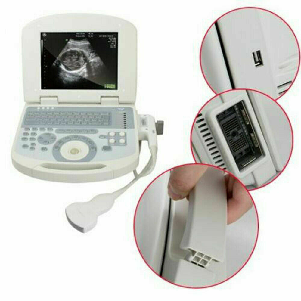 Portable Digital Laptop Medical Ultrasound Scanner Machine+3.5 Convex probe+Gift DIAGNOSTIC ULTRASOUND MACHINES FOR SALE