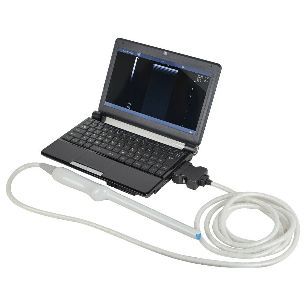10" Portable Laptop Ultrasound Scanner Machine System Linear Transvaginal Probes DIAGNOSTIC ULTRASOUND MACHINES FOR SALE