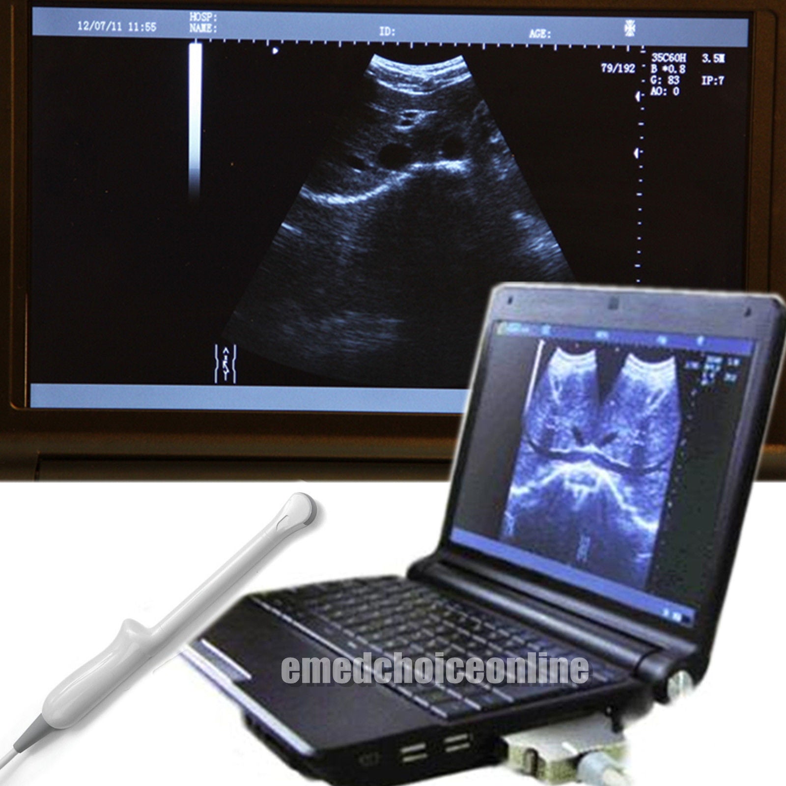Full Digital Laptop 3D Ultrasound Scanner 6.5 MHZ transvaginal Probe Pregnancy DIAGNOSTIC ULTRASOUND MACHINES FOR SALE