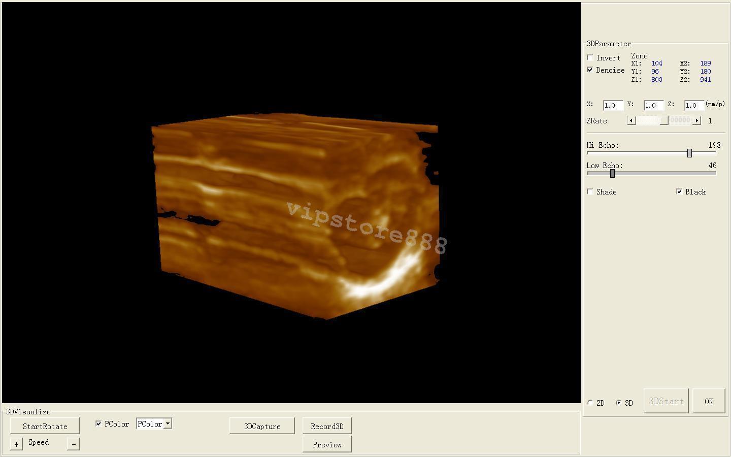 Ultrasonic Digital Ultrasound Scanner Convex + Linear 2Probes / Sensors Machine DIAGNOSTIC ULTRASOUND MACHINES FOR SALE