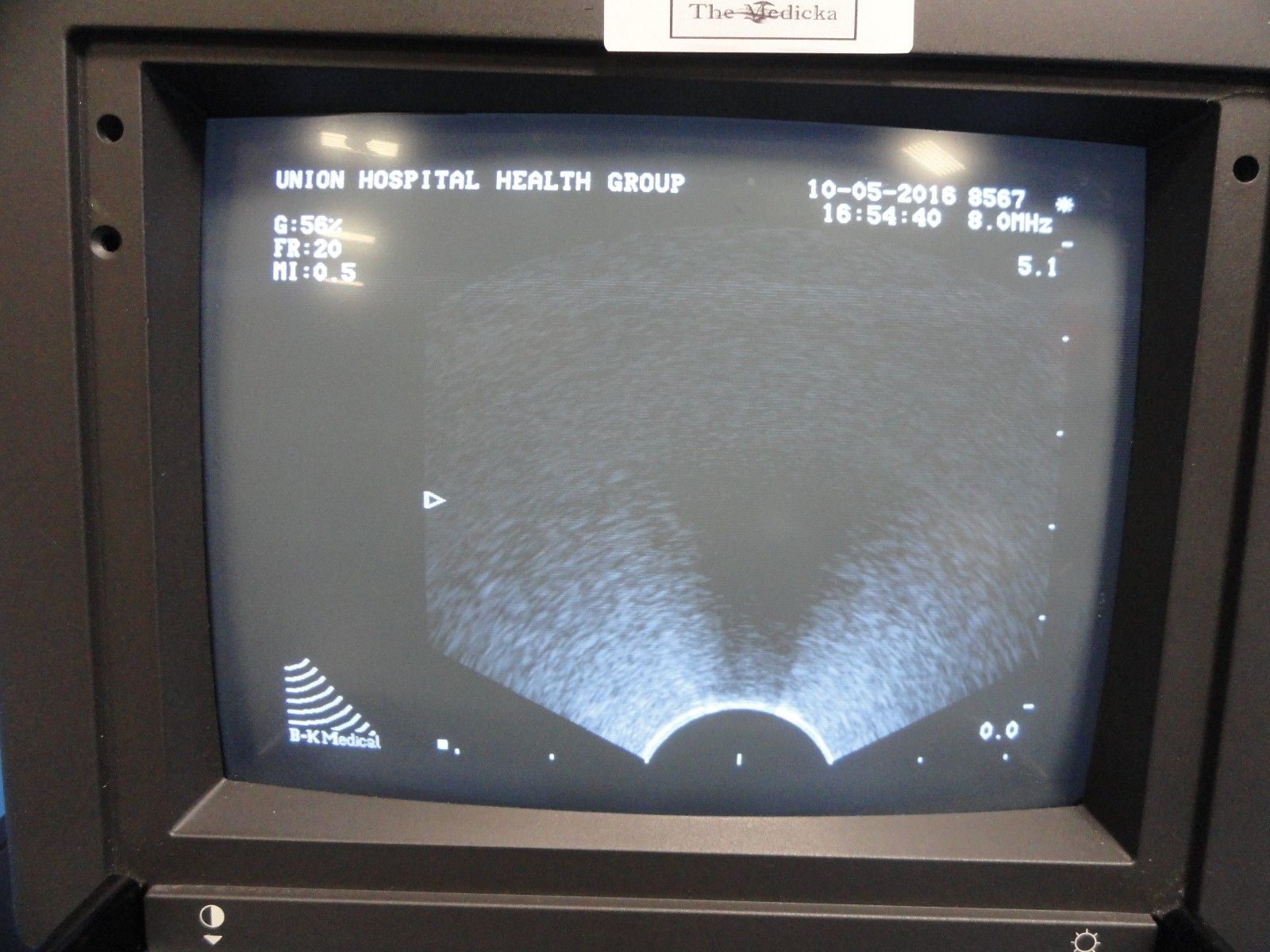 B-K Medical REF Type 8567-S 8 MHz MFI Convex Array Endocavity Probe (11444) DIAGNOSTIC ULTRASOUND MACHINES FOR SALE