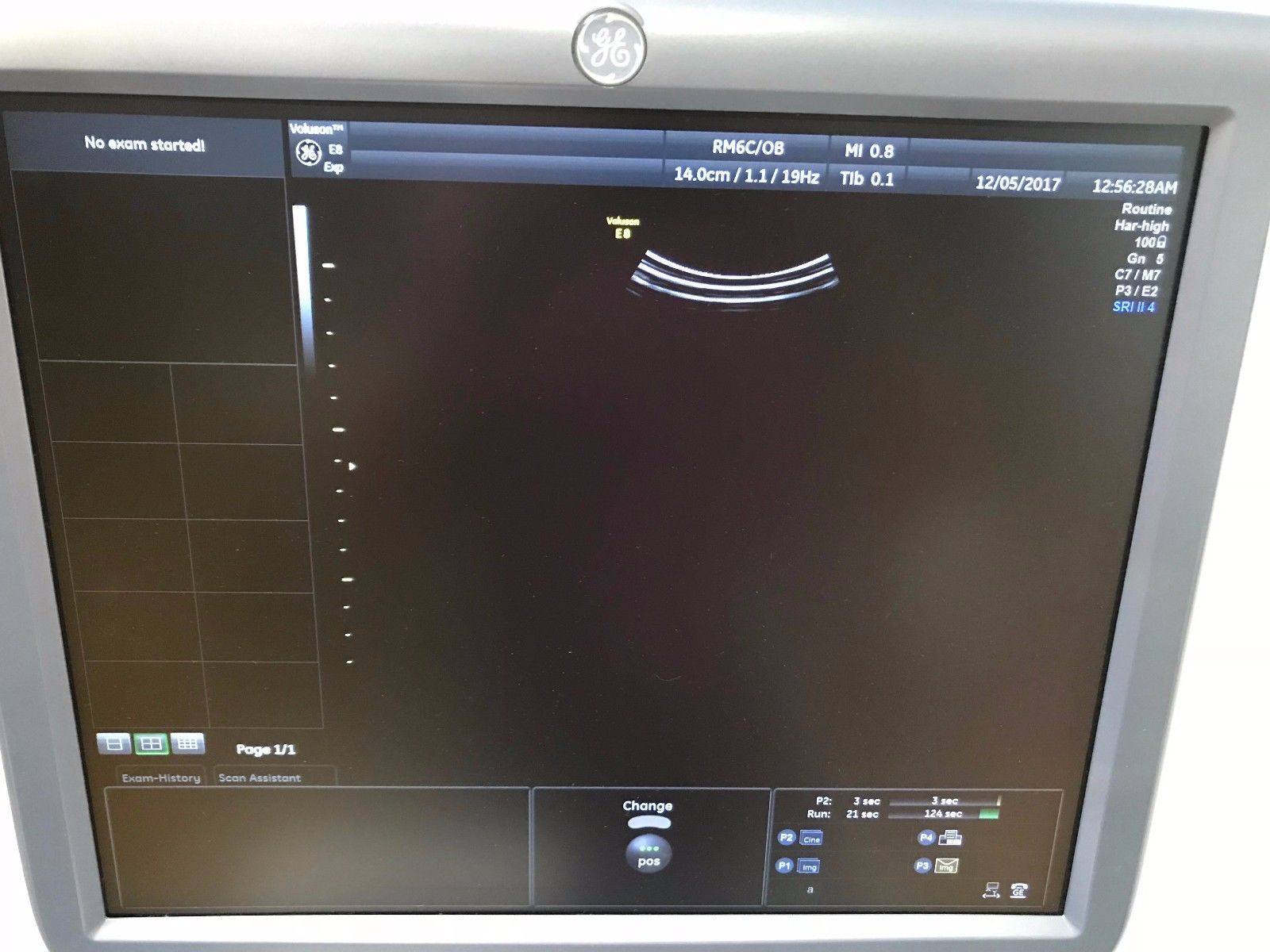 GE VOLUSON E8 BT13 HD LIVE ULTRASOUND WITH RM6C, C1-5D, IC5-9D PROBES DIAGNOSTIC ULTRASOUND MACHINES FOR SALE