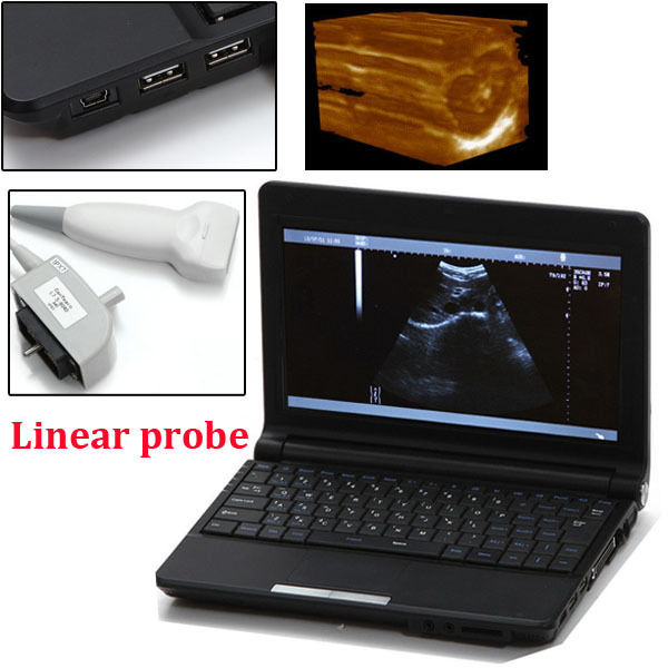 New +3D Software Laptop Ultrasound Machine Scanner system + Linear Probe 7.5MHZ DIAGNOSTIC ULTRASOUND MACHINES FOR SALE