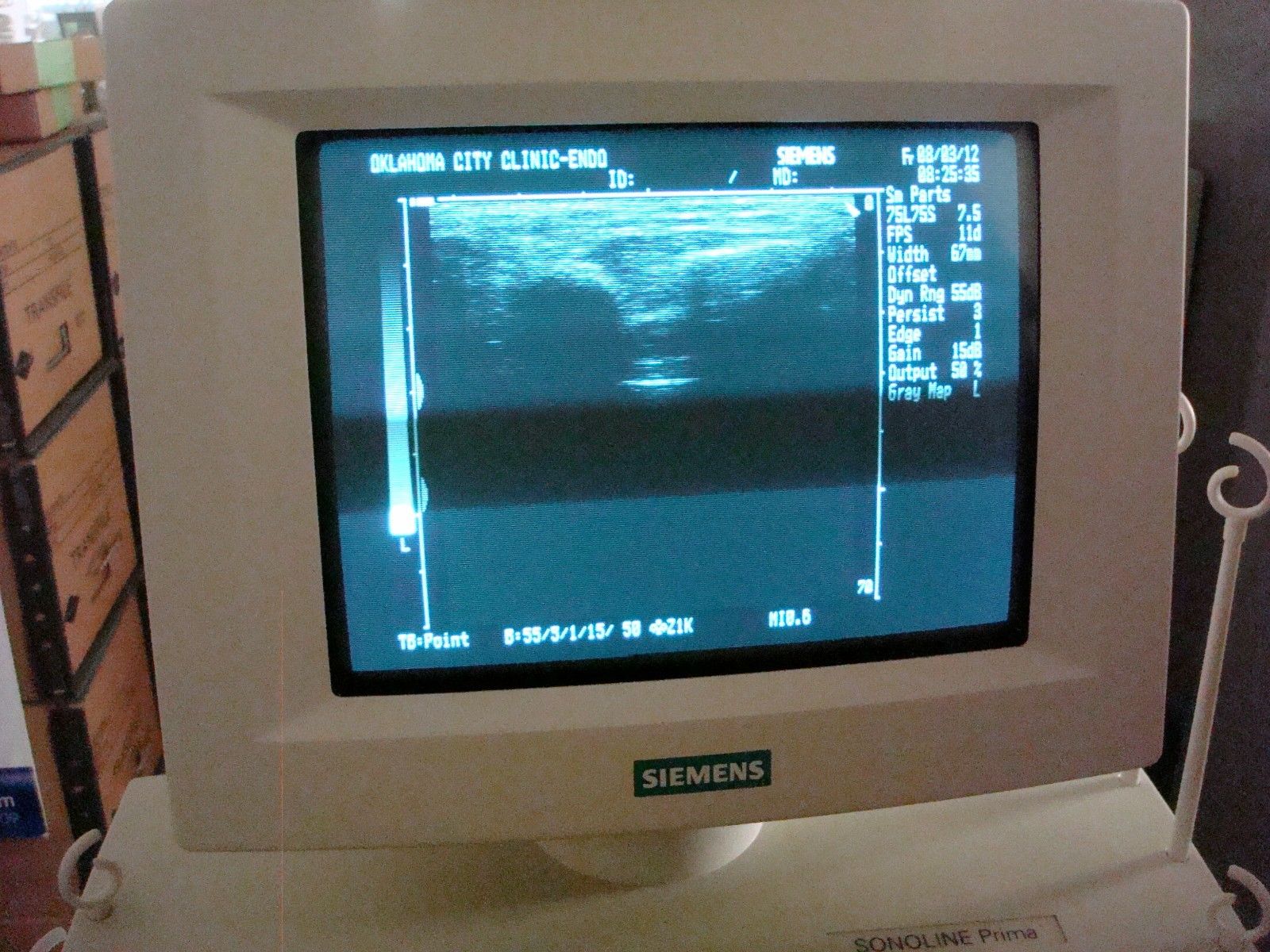 Siemens Sonoline Prima 1995 Ultrasound DIAGNOSTIC ULTRASOUND MACHINES FOR SALE