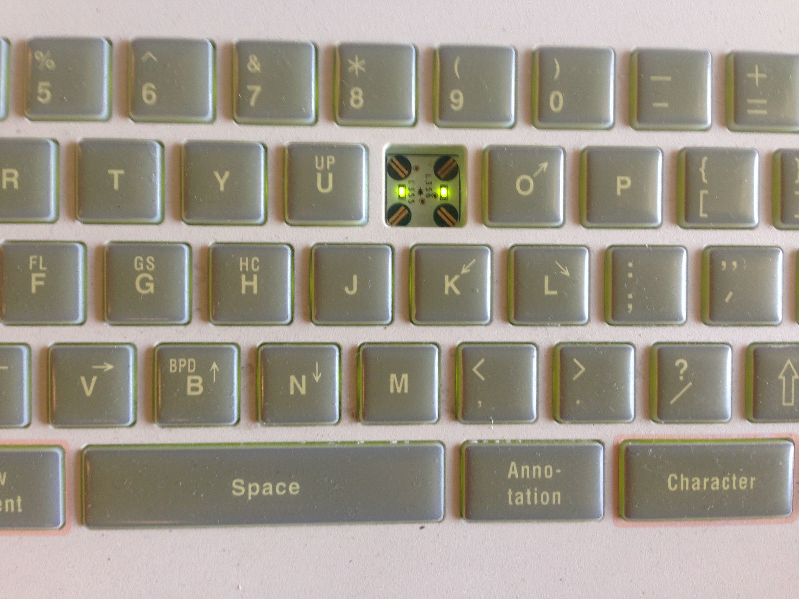 Hitachi EUB-6000 Ultrasound Machine Scanner with Foot Pedal and Recorder DIAGNOSTIC ULTRASOUND MACHINES FOR SALE