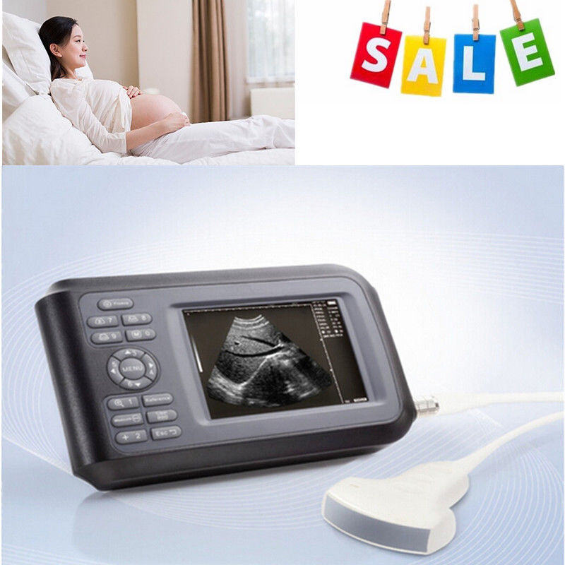 Portable HandScan 5.5'' Digital Ultrasound Scanner Machine+Convex Probe+Oximeter 190891400826 DIAGNOSTIC ULTRASOUND MACHINES FOR SALE