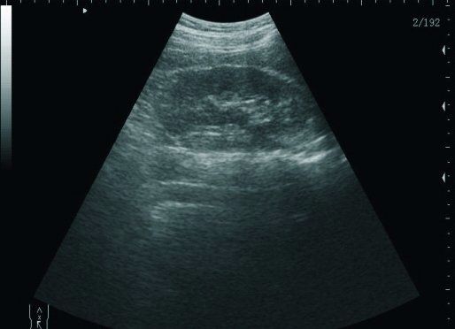 Laptop Digital Ultrasound scanner with Transvaginal probe,+3D With Box CE A+ 190891499356 DIAGNOSTIC ULTRASOUND MACHINES FOR SALE